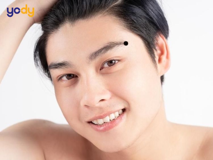 Nốt ruồi đuôi lông mày phải nam