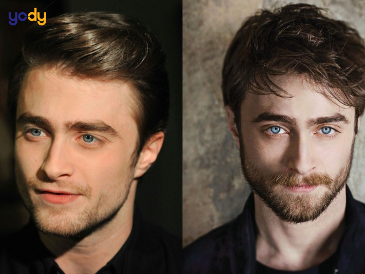 Lông mày giao nhau ở đàn ông